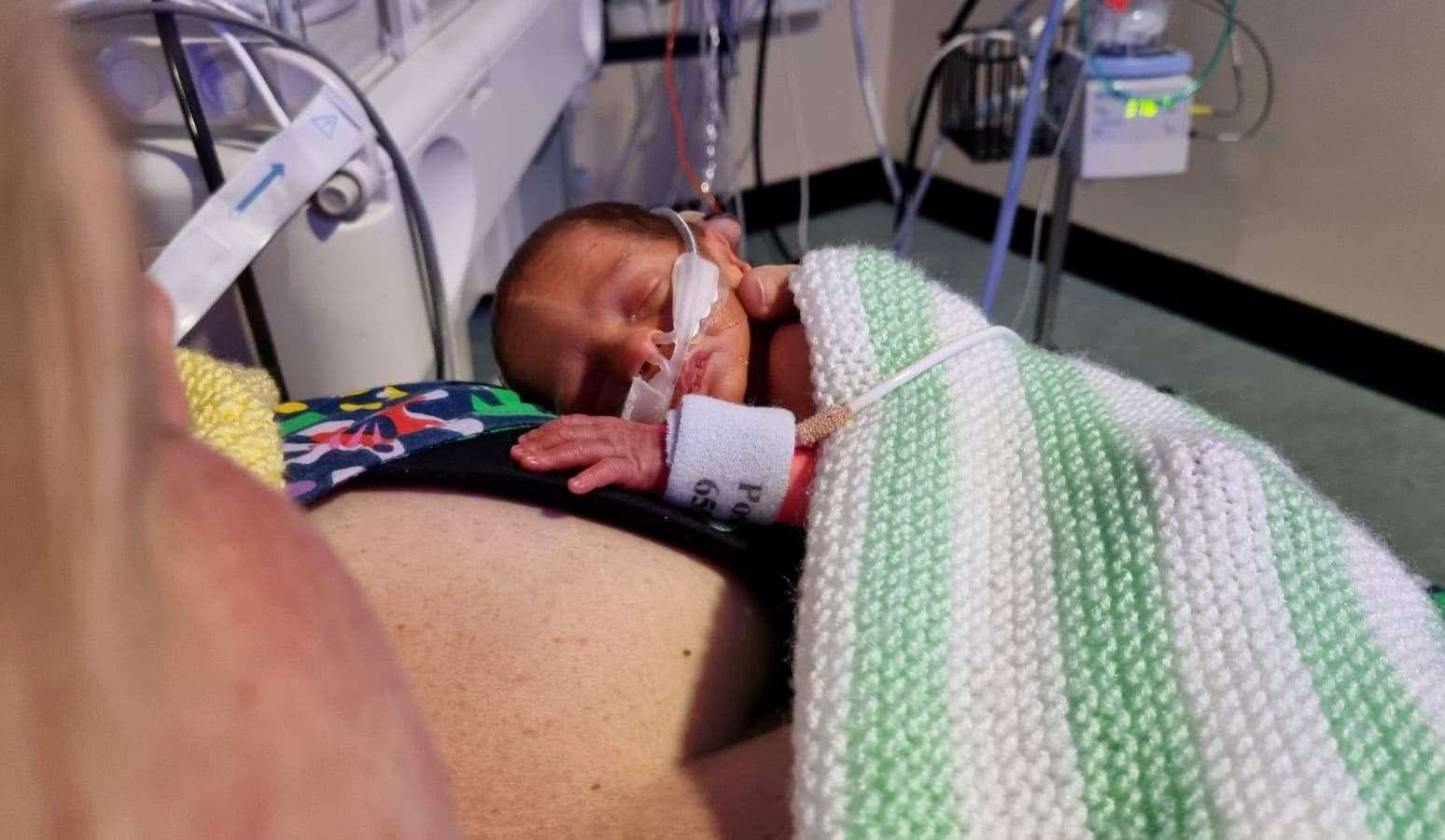 Rupert was born 11 weeks early. Picture: SWNS