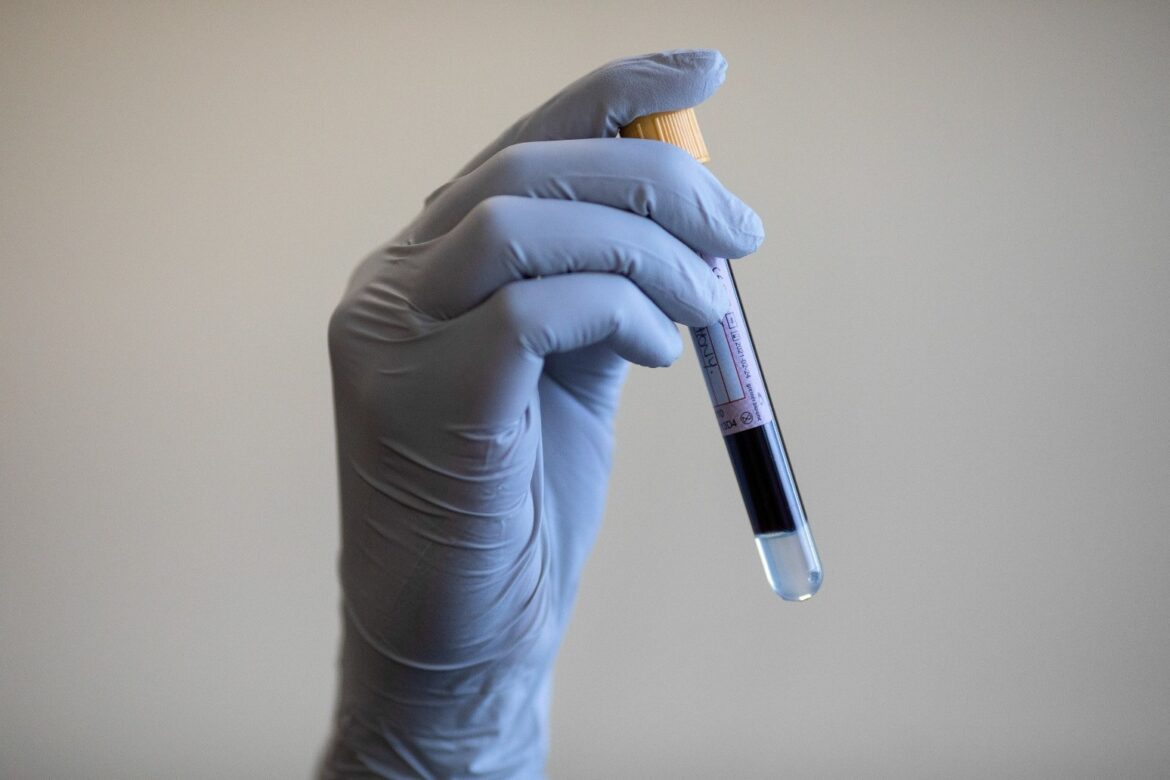 Blood test can predict dementia