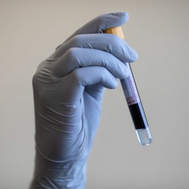 Blood test can predict dementia