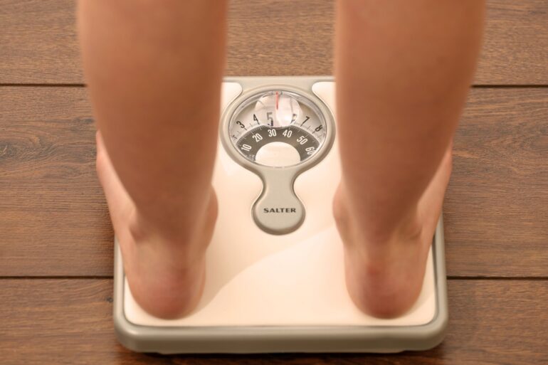 Children with obesity have higher MS risk