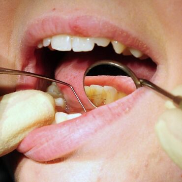 Minister challenged over plan to boost dentistry