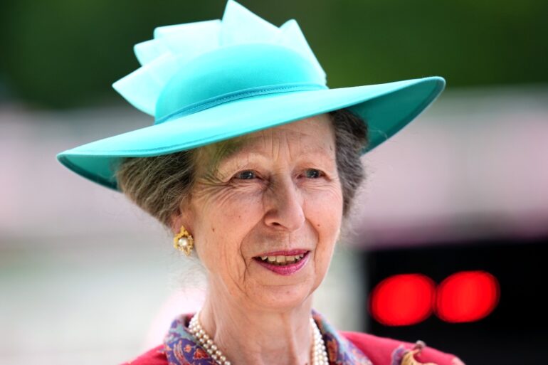 Princess Anne in hospital after minor injuries and concussion