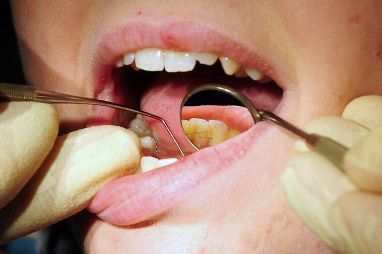 Concerns raised about dental health in deprived areas