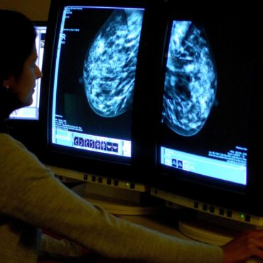 UK cancer outcomes ‘lag behind’ those of countries with clear plan, say experts