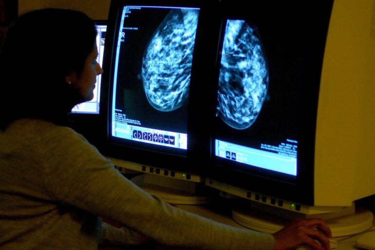 UK cancer outcomes ‘lag behind’ those of countries with clear plan, say experts