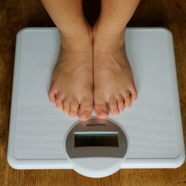 People being misdiagnosed on obesity say experts