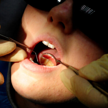 22 million people in need of urgent NHS dental care