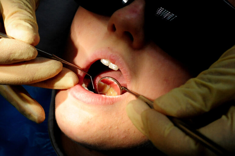 22 million people in need of urgent NHS dental care