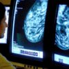 Breast cancer cases and deaths set to rise dramatically by 2050 data suggests