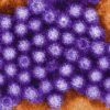 Experts warn of second norovirus wave