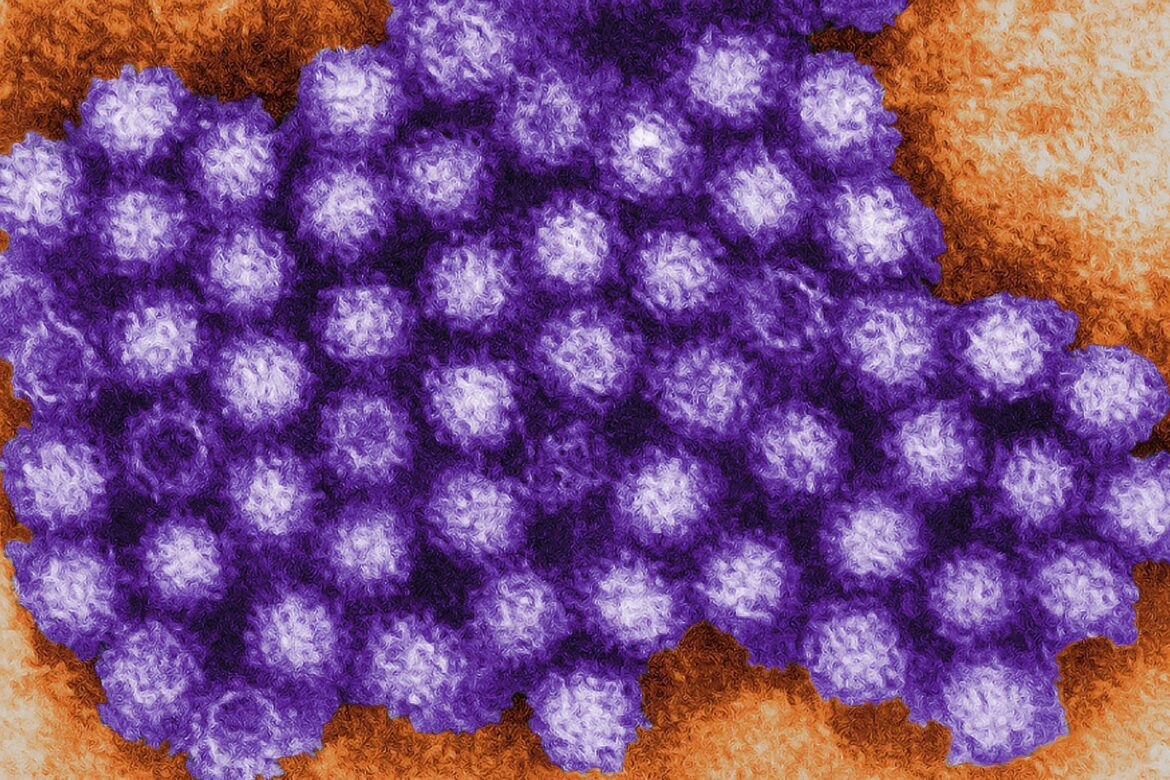 Experts warn of second norovirus wave