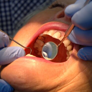 Ministers vow boost dentistry access with 700000 appointments rollout