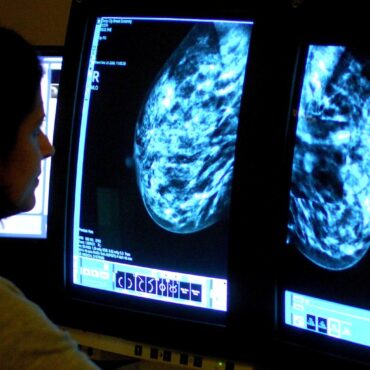 Record number of women up to date with breast screening figures show