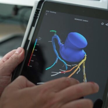 State of the art 3D heart scanner saves lives and NHS millions