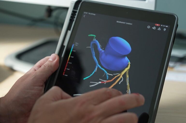 State of the art 3D heart scanner saves lives and NHS millions