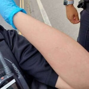 Woman jailed after spitting and biting officer’s arm during arrest